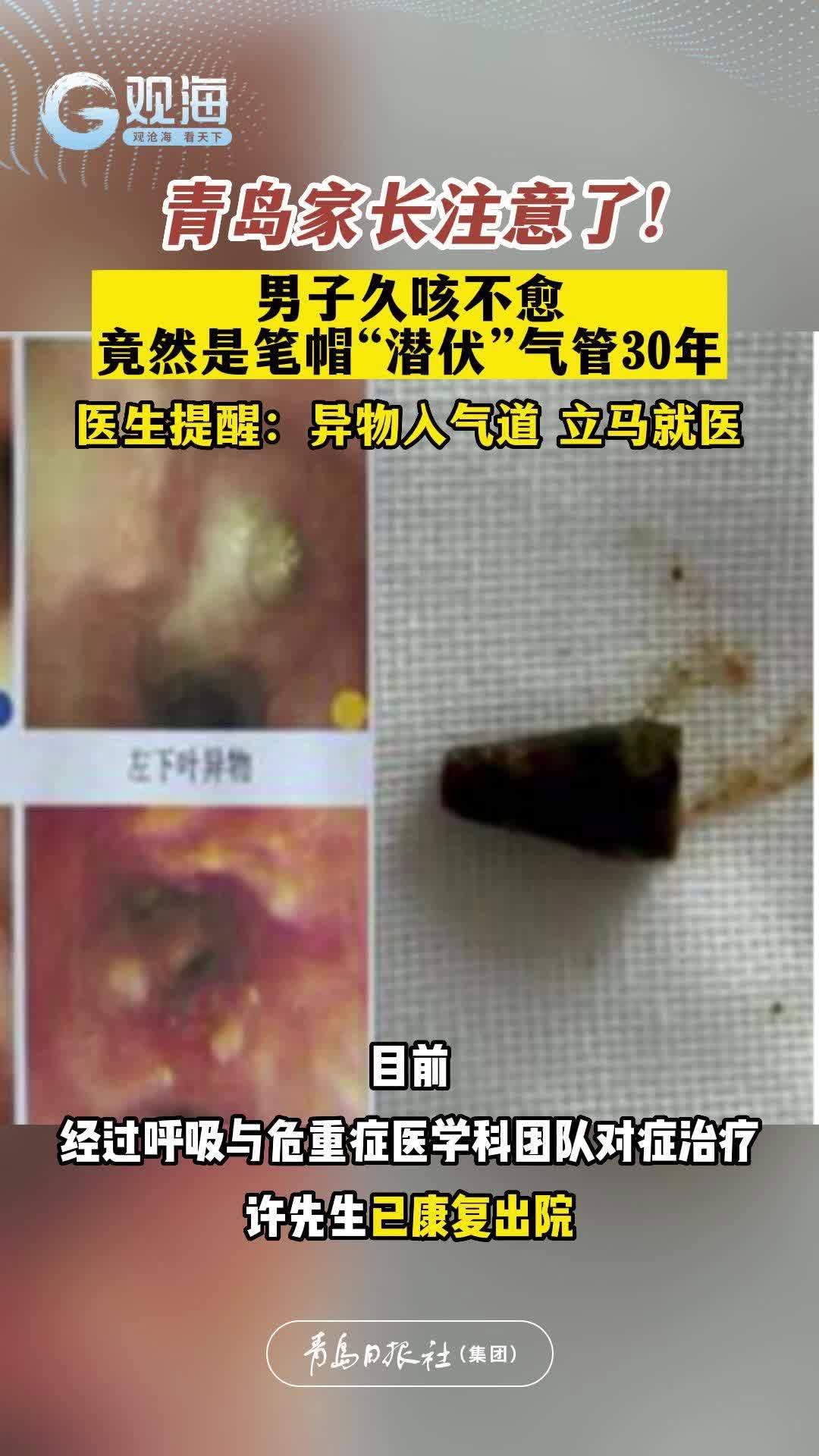 男子久咳不愈，竟然是笔帽“潜伏”气管30年……青岛家长注意了！