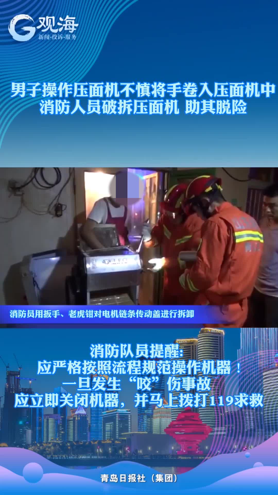 手被“咬”!看着都疼